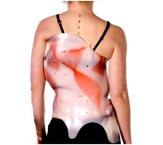 Advanced Scoliosis Brace