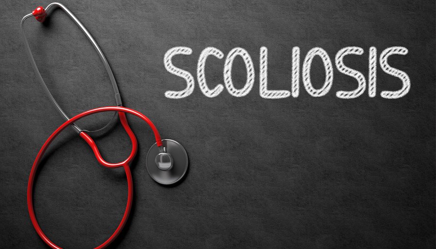 scoliosis treatment fort collins