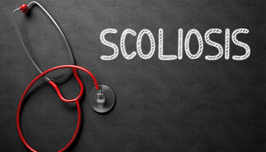 Intensive Scoliosis Treatment in Fort Collins, CO, Fort Collins Back Pain